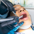 Understanding the Numbers at the Dentist: What Does a 4 Mean?