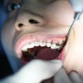 Why Regular Dental Checkups are Essential for Optimal Oral Health