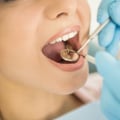 The Ultimate Guide to the Highest Dental Degree